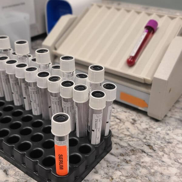 Bloodwork and urinalysis being done for kidney disease treatment for cats and dogs